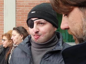 legnano sfregiato acido patteggiamento