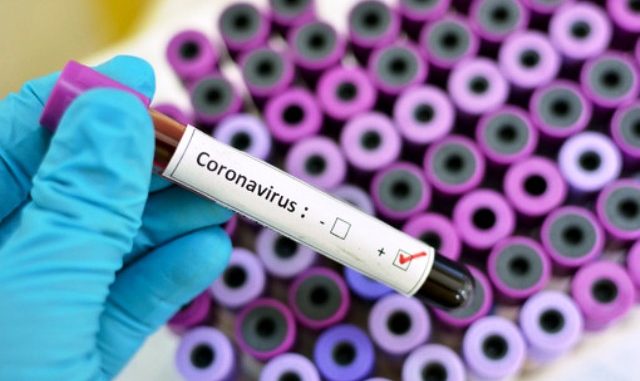 Villacortese coronavirus gruppocap collegiodeicapitani