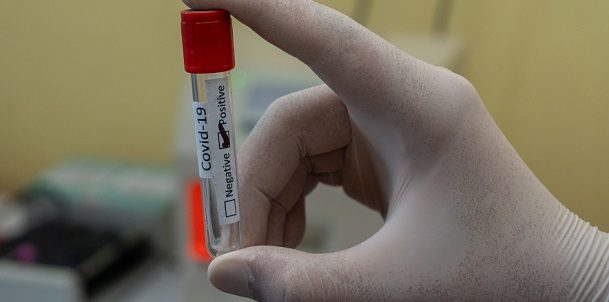castellanza farmacia san giulio tamponi studenti
