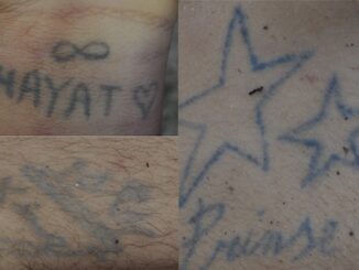 Lonate cadavere 336 tatuaggi