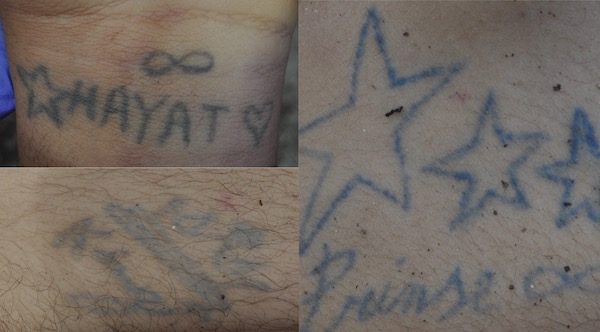 Lonate cadavere 336 tatuaggi