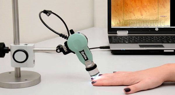 legnano ospedale diagnosi sclerodermia