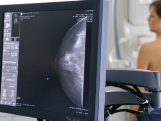 regione tumore seno screening