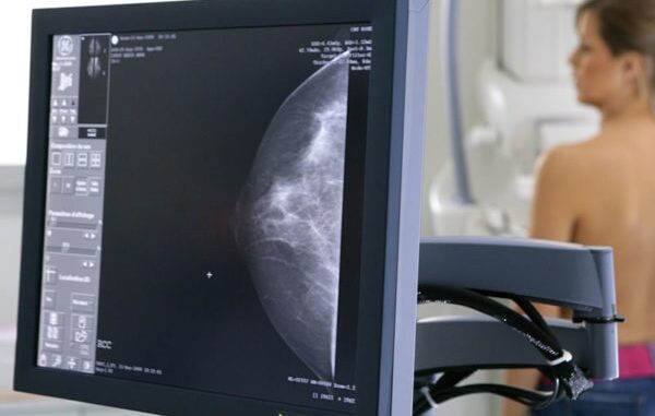 regione tumore seno screening