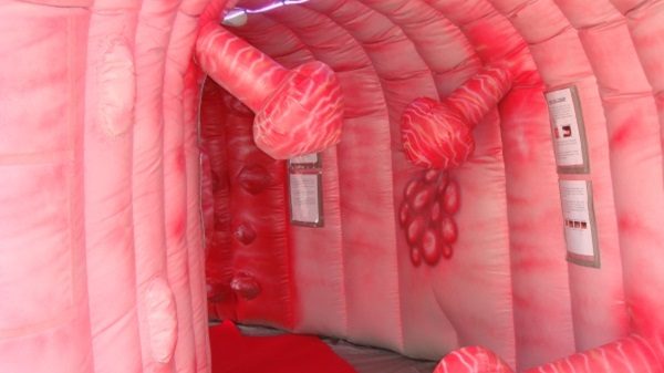 colon gonfiabile prevenzione
