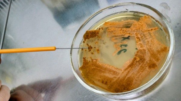 insubria scoperto antibiotico superbatteri