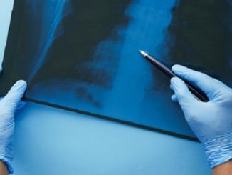 radiografia