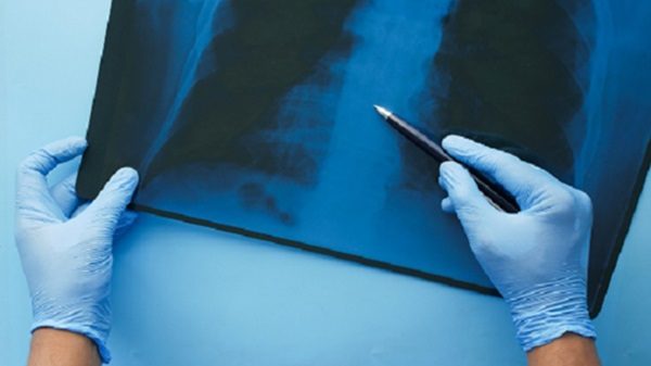 radiografia