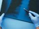 radiografia