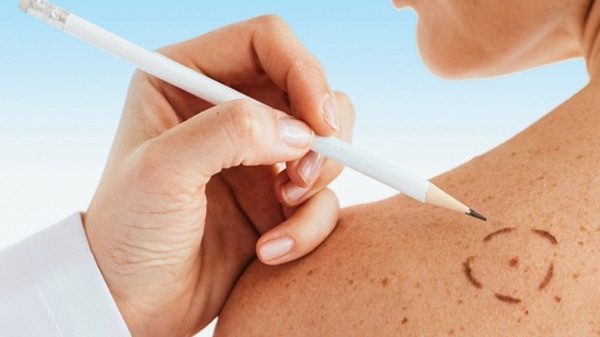 Lonate visite dermatologiche gratis